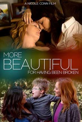 More Beautiful for Having Been Broken - Legendado Download Torrent